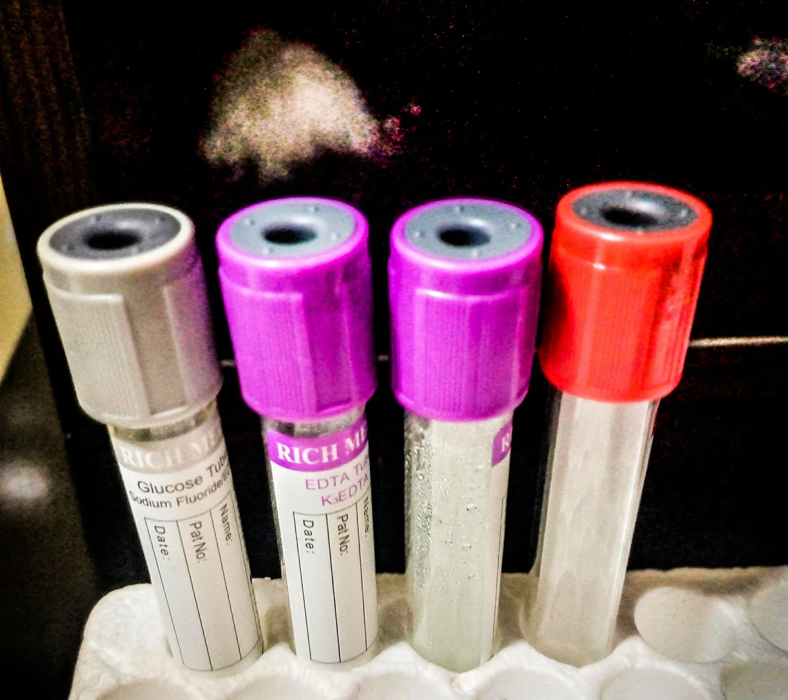 Inflammation chronique silencieuse : les signes à repérer